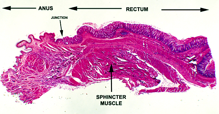 anal rectal junction Anal rectal junction